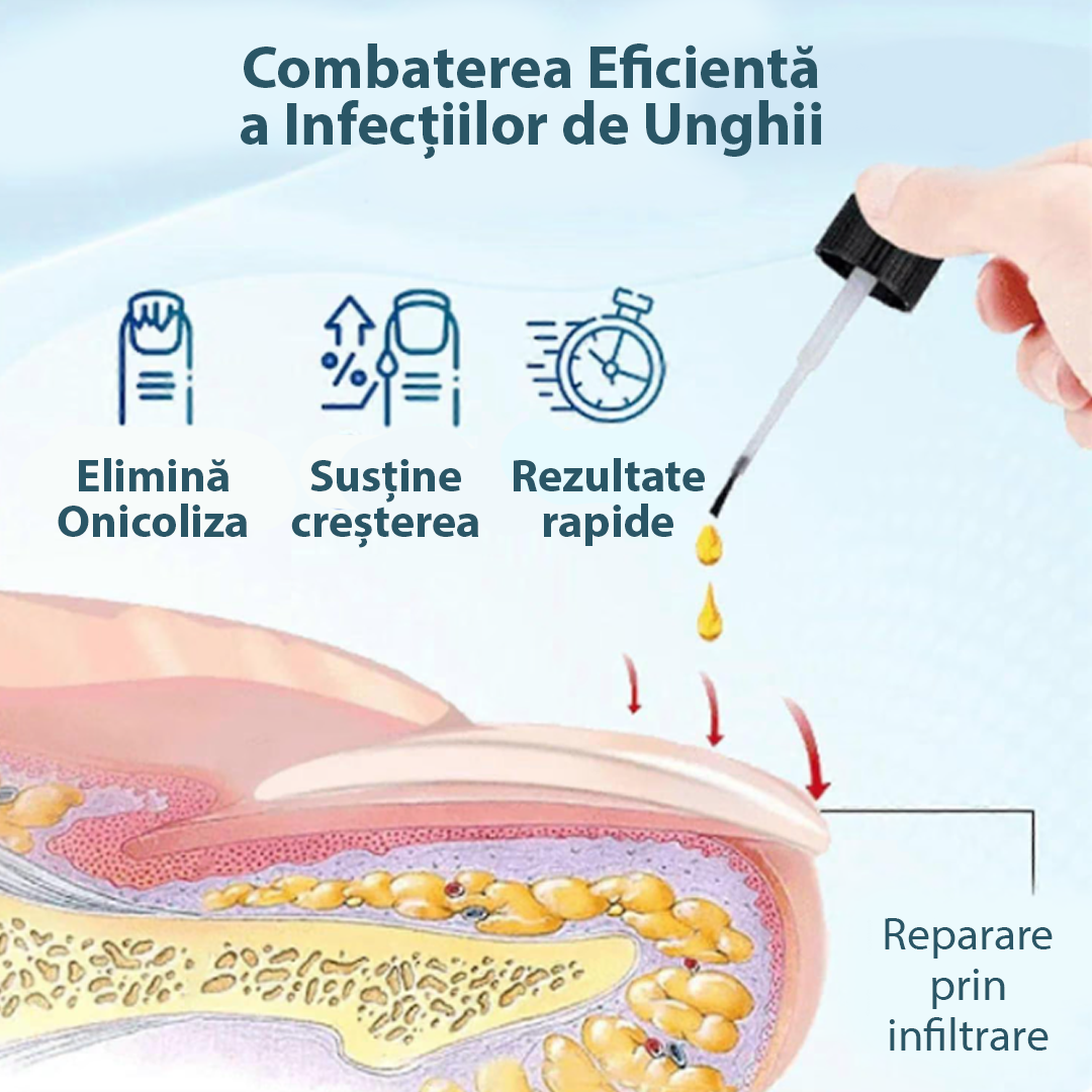 Tratament pentru unghii